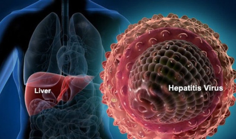 Những điều bạn cần biết về viêm gan B cấp tính 1