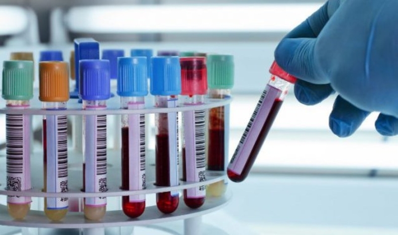 Những điều bạn cần biết về viêm gan B cấp tính 2