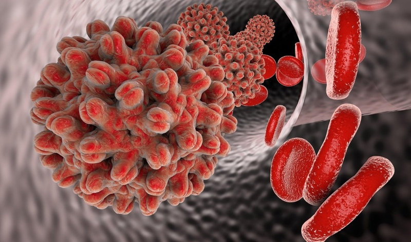 Những điều bạn cần biết về viêm gan B cấp tính 3