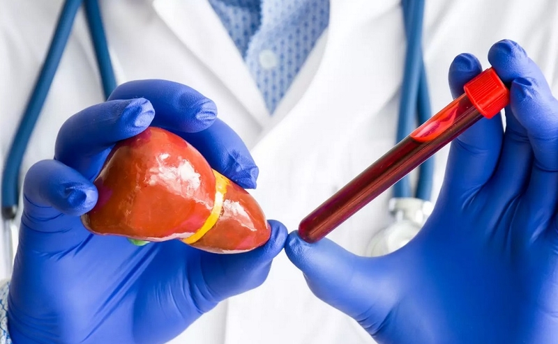 Những điều bạn cần biết về xét nghiệm đo hoạt độ GGT Gama Glutamyl transferase máu 2