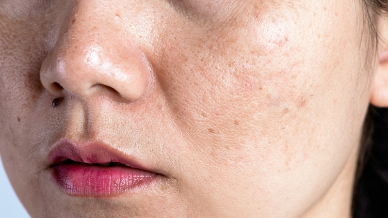 Những điều cần biết nếu muốn kết hợp Niacinamide và Retinol 2