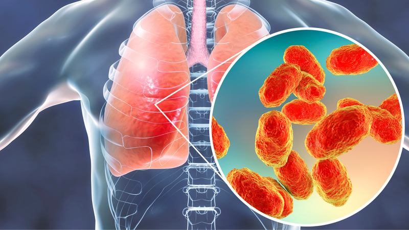 Những điều cần biết và phác đồ điều trị Mycoplasma 2