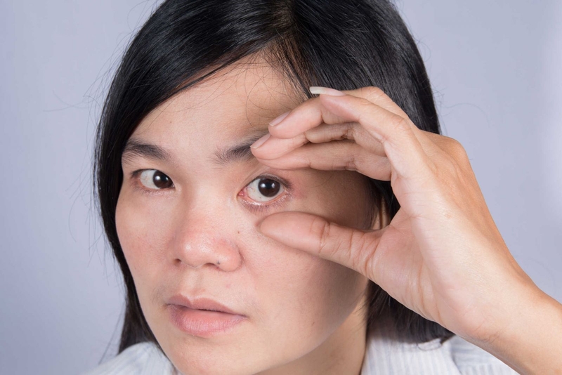 Những điều cần biết về bệnh đau mắt đỏ mãn tính 1