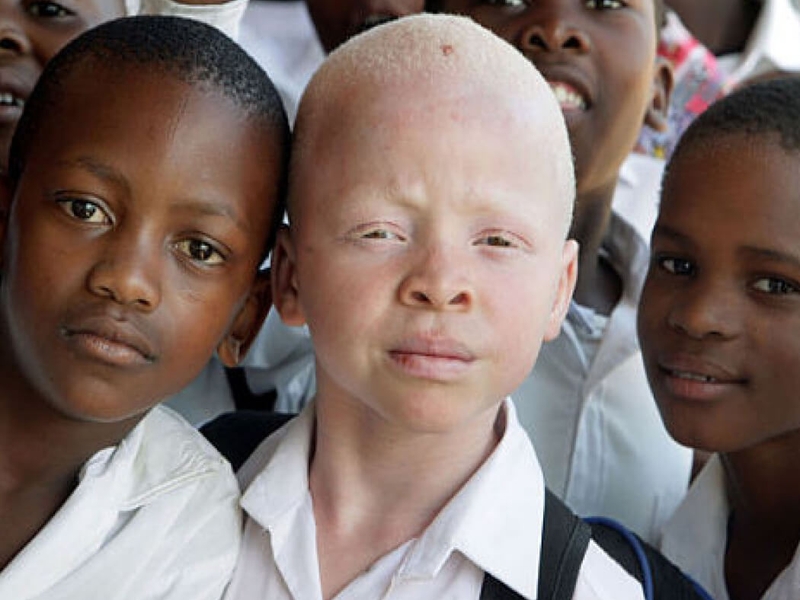 nhung-dieu-can-biet-ve-benh-hiem-va-ngay-benh-hiem 1.jpg