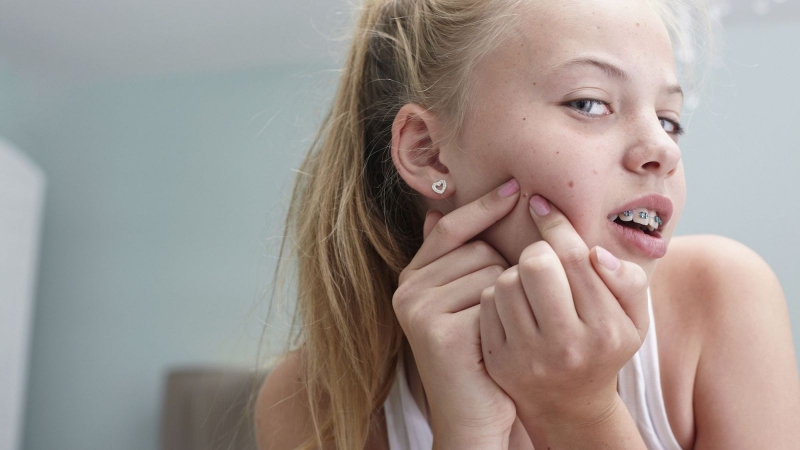 Những điều cần biết về buồng trứng đa nang ở tuổi dậy thì 2