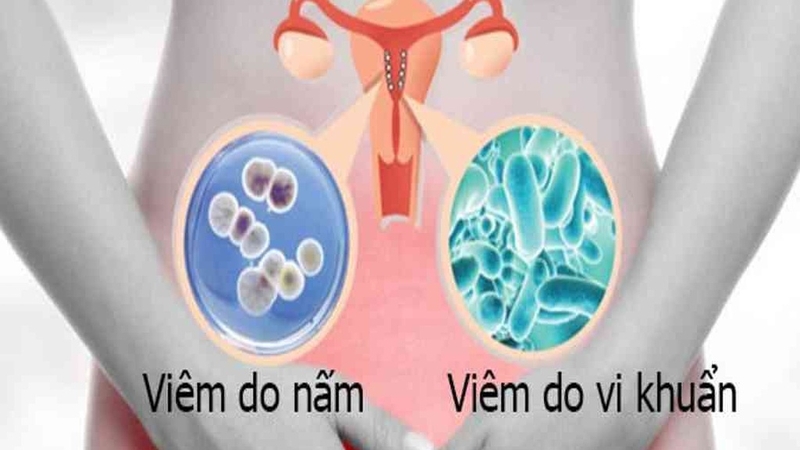 Những điều cần biết về cách quan hệ không bị viêm nhiễm 1