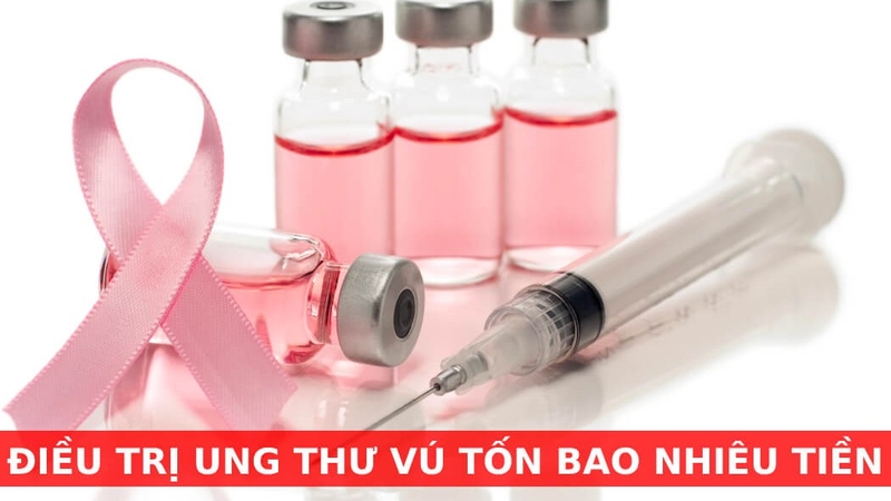 Những điều cần biết về ung thư vú và chi phí điều trị ung thư vú 4
