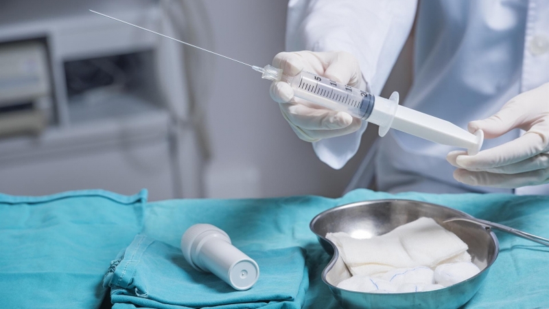 Những điều cần biết về chọc dò dịch ối và sinh thiết tua nhau thai 2