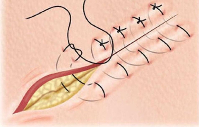 nhung-dieu-can-biet-ve-khau-vet-thuong 2.jpg