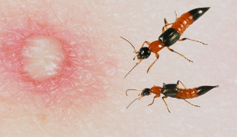 Những điều cần biết về kiến ba khoang và độc tính kiến ba khoang 3