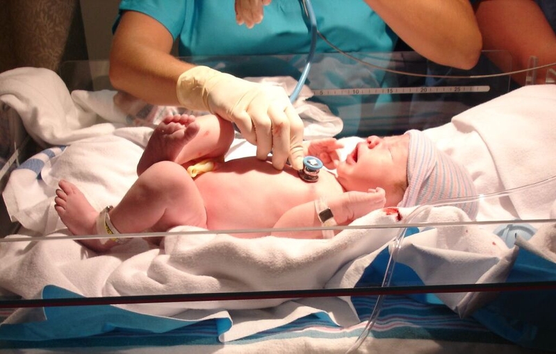 Những điều cần biết về kỹ thuật đặt catheter tĩnh mạch rốn cho trẻ sơ sinh 2