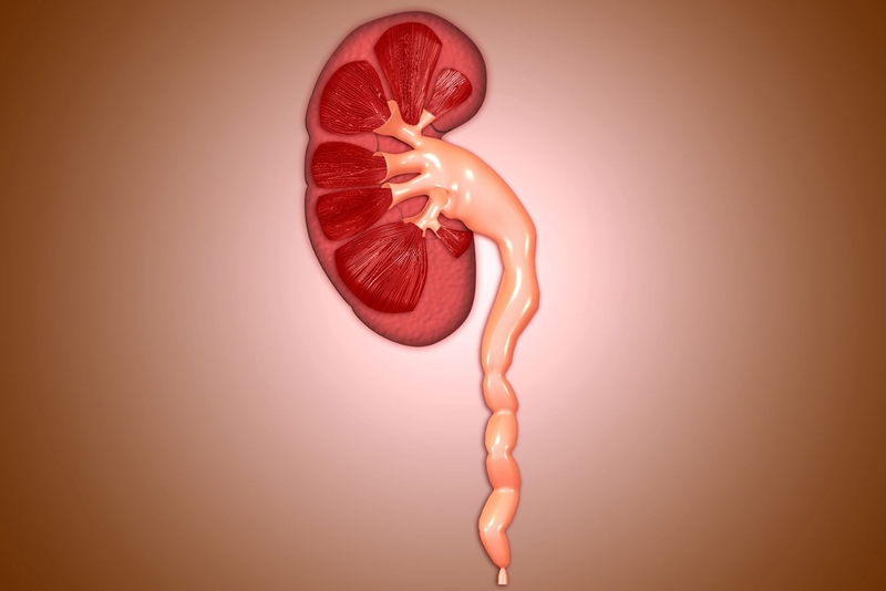 Những điều cần biết về nội soi tán sỏi niệu quản 3