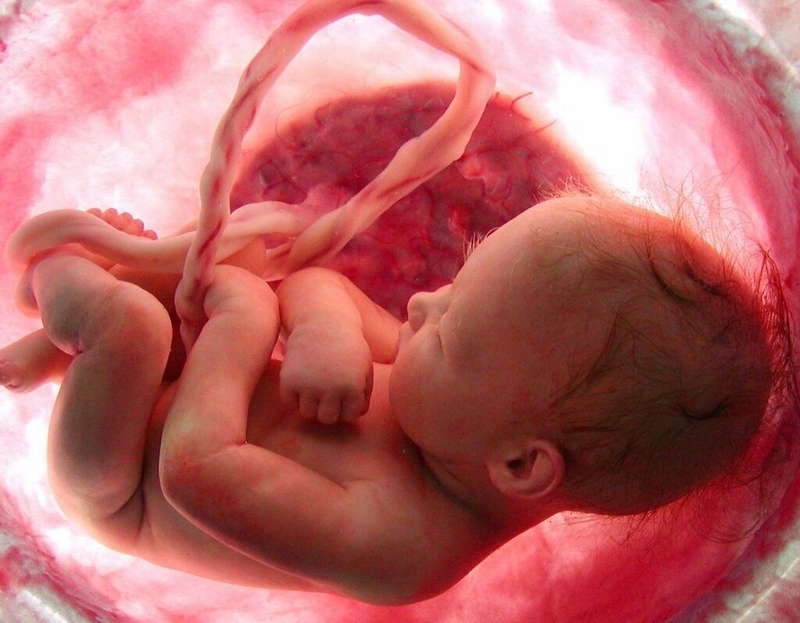 Những điều cần biết về phương pháp đo AFI và ý nghĩa của chỉ số nước ối AFI 1