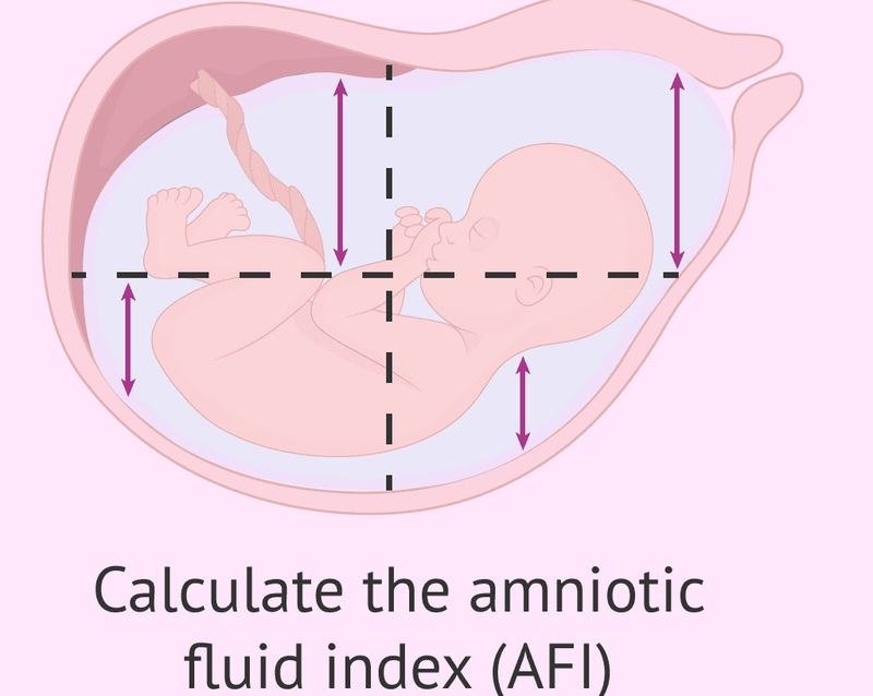 Những điều cần biết về phương pháp đo AFI và ý nghĩa của chỉ số nước ối AFI 2