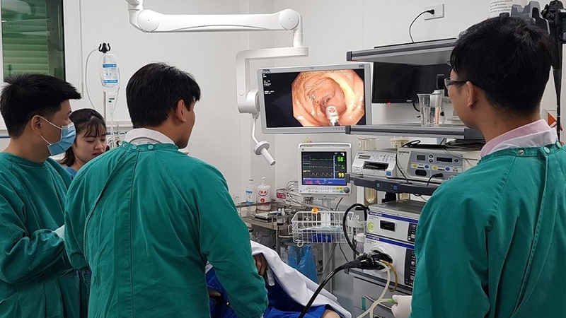 Những điều cần biết về phương pháp siêu âm nội soi 1