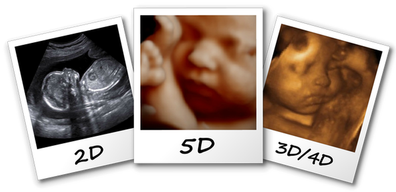 Những điều cần biết về siêu âm 5D 2