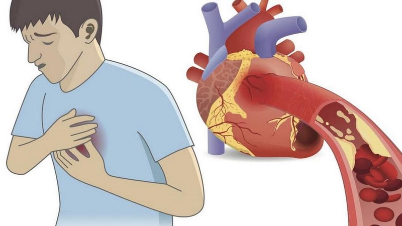 Những điều cần biết về tiếp cận hạ kali máu 1