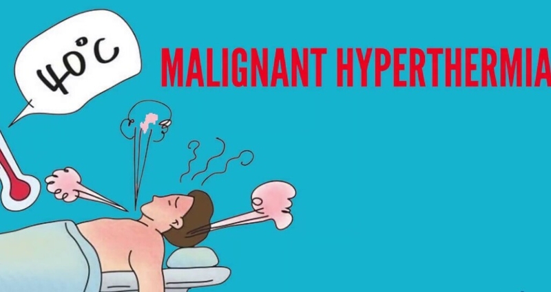 Những điều cần biết về tình trạng tăng thân nhiệt ác tính trong gây mê 3