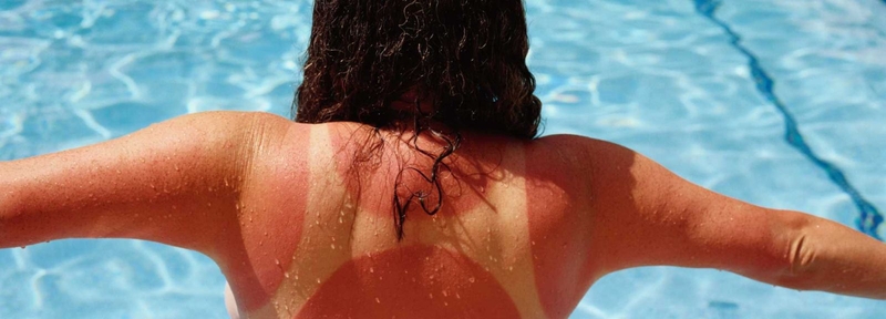 Những điều cần biết về ung thư da4