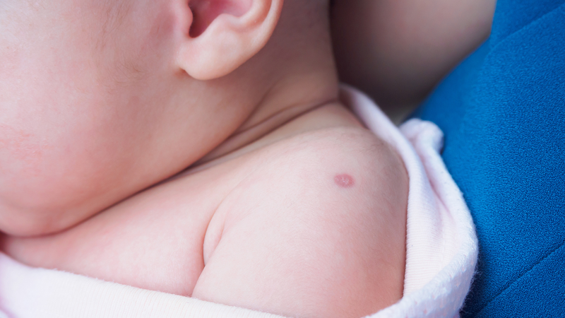 Những điều cần biết về vắc xin lao phổi 2