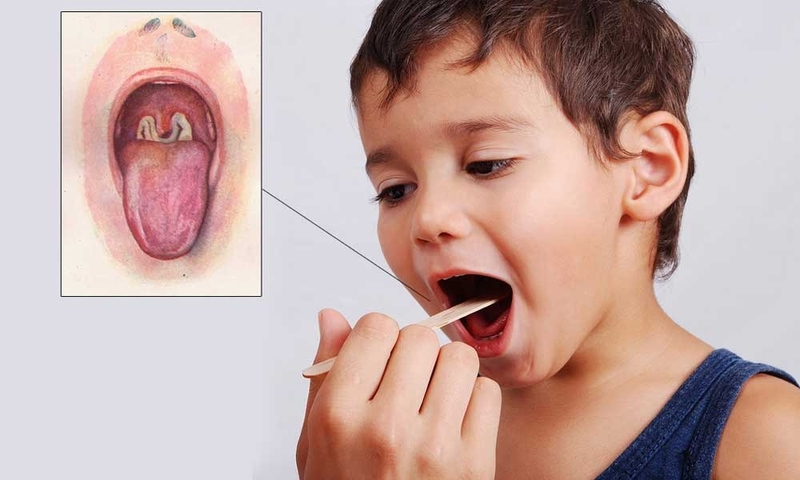 Vi khuẩn bạch hầu: Môi trường sống, cách thức lây nhiễm bệnh 2