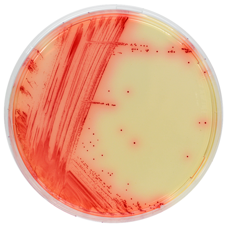 Những điều cần biết về vi khuẩn Mycoplasma1