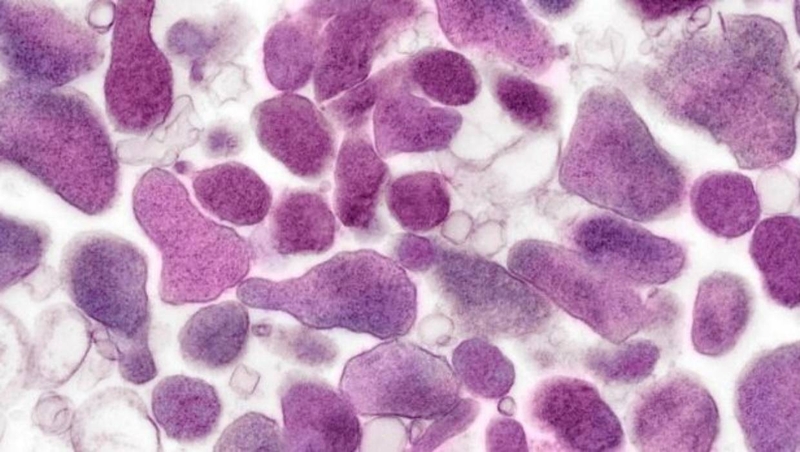 Những điều cần biết về vi khuẩn Mycoplasma2