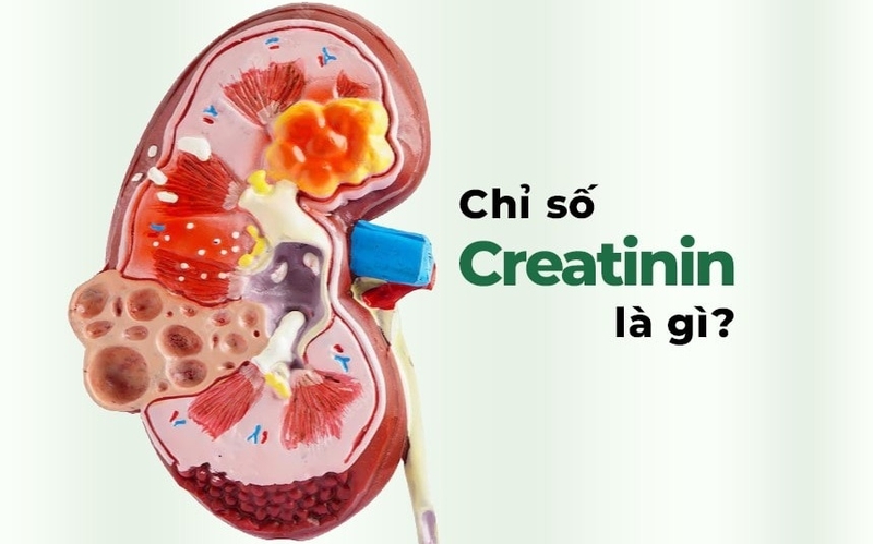 Creatinin trong xét nghiệm máu là chỉ số phản ánh chức năng thận.