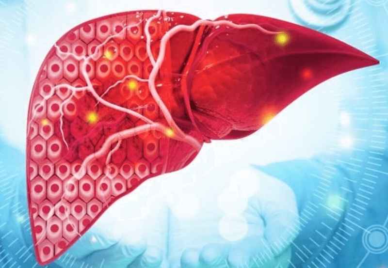 Những điều cần biết về xét nghiệm DCP và căn bệnh ung thư gan 1