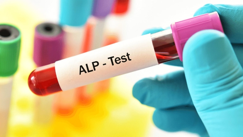 Những điều cần biết về xét nghiệm phosphatase kiềm 1