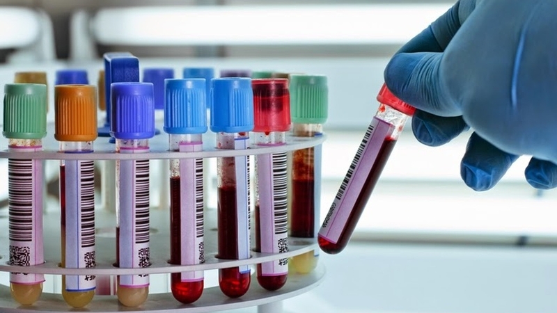 Những điều cần biết về xét nghiệm phosphatase kiềm 2