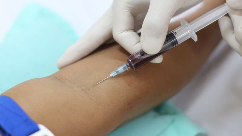 Những điều cần biết về xét nghiệm phosphatase kiềm 3