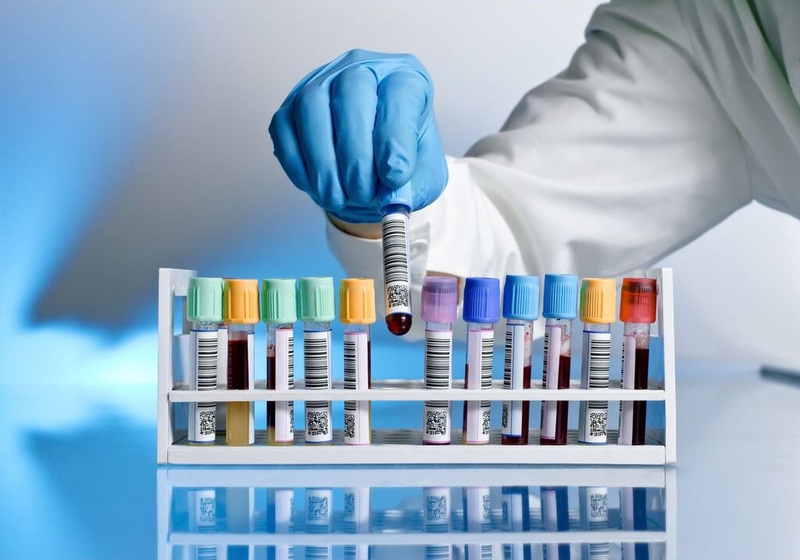 Những điều cần biết về xét nghiệm TSI, quy trình xét nghiệm TSI và bệnh Basedow 2