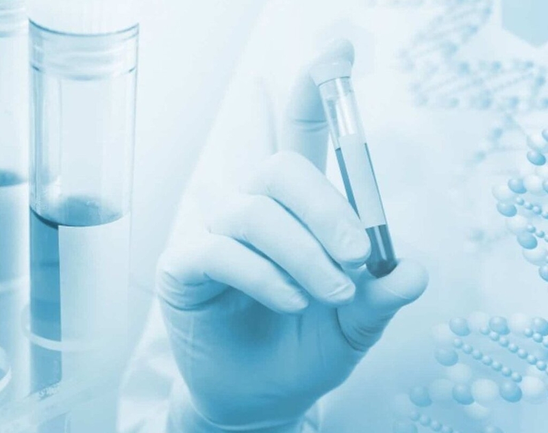 Những điều cần biết về xét nghiệm widal: Xét nghiệm tìm kháng thể kháng thương hàn 2