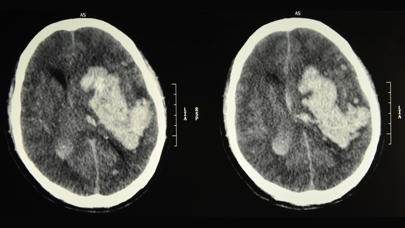 nhung-dieu-cha-me-can-biet-ve-tiem-vitamin-k-cho-tre-so-sinh 1.png