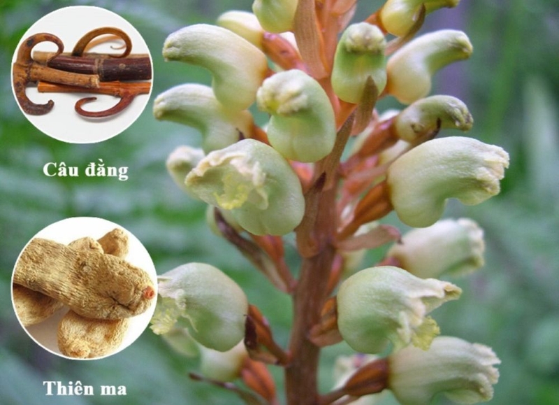 Những điều ít biết về chứng run tay chân ở người trẻ và cách điều trị hiệu quả 4