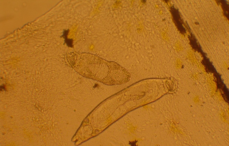 Những điều quan trọng bạn cần phải biết về dinh dưỡng sán lá gan 3