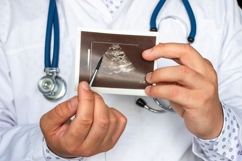 Những lầm tưởng phổ biến về bệnh lạc nội mạc tử cung 1