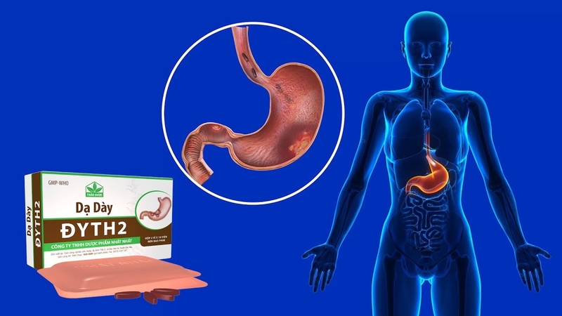 Những loại thuốc chữa viêm loét dạ dày hiệu quả 3