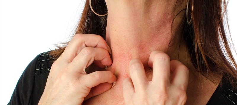 Những lời khuyên bổ ích cho người bị bệnh dị ứng với kim loại 1