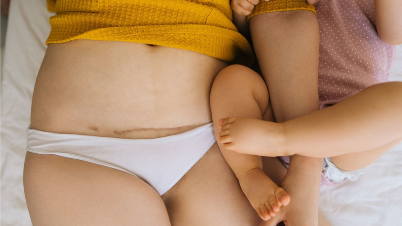 Những lưu ý khi đẻ mổ mà các mẹ bầu cần biết 2