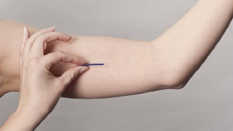 Những lưu ý sau khi cấy que tránh thai để đạt hiệu quả cho chị em 2