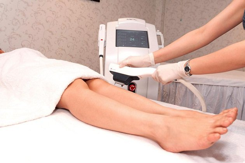 Những lưu ý khi triệt lông bằng laser bạn đã biết chưa
