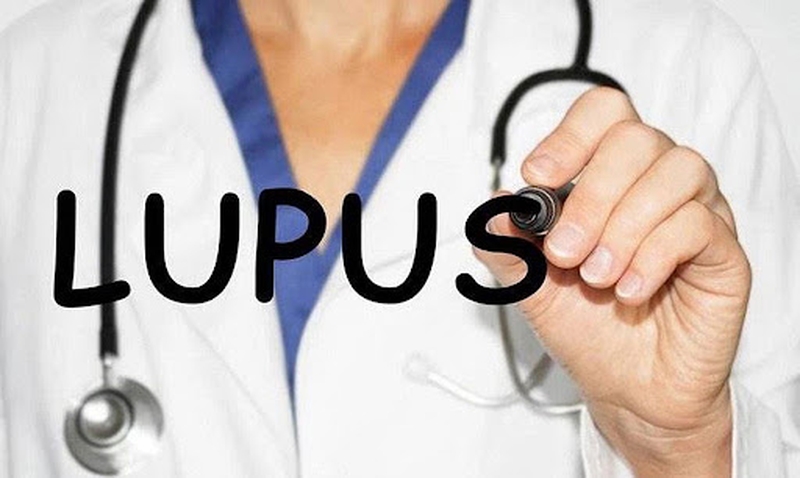 Những lưu ý về chế độ ăn cho người bị lupus ban đỏ nhẹ 1