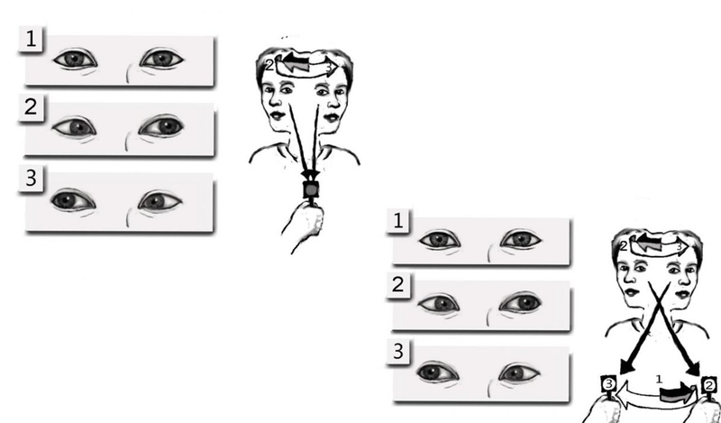Mẹo chữa rối loạn tiền đình bằng vật lí trị liệu