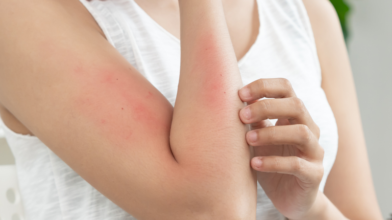 Mặc dù yến sào chứa nhiều dưỡng chất, một số người vẫn có nguy cơ gặp phản ứng dị ứng