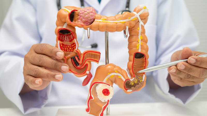 Rối loạn chức năng đại tràng có thể khiến việc đi tiêu trở nên khó khăn