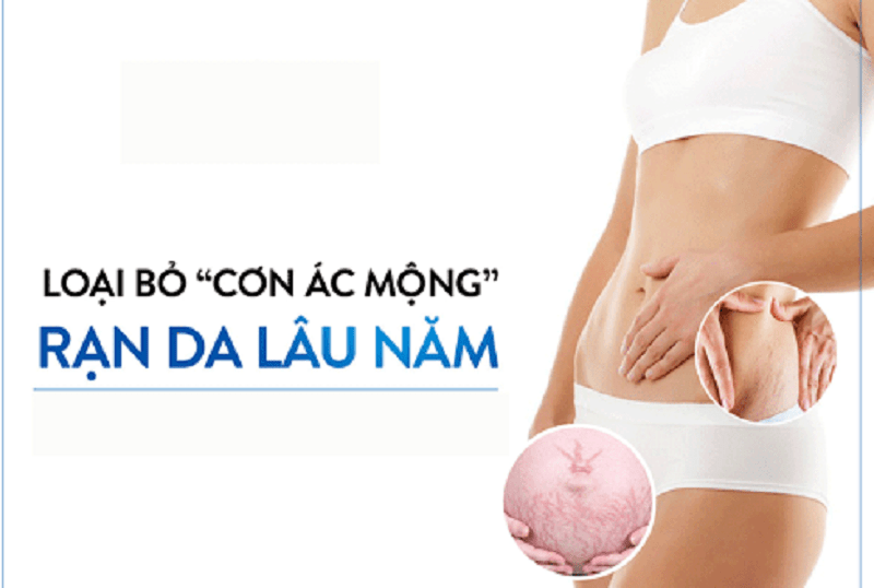 nhung-nguyen-nhan-khien-ban-bi-ran-da-va-cach-phong-tranh