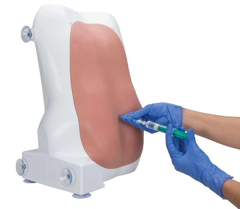 Những phương pháp chẩn đoán bệnh ung thư ở trẻ em 2