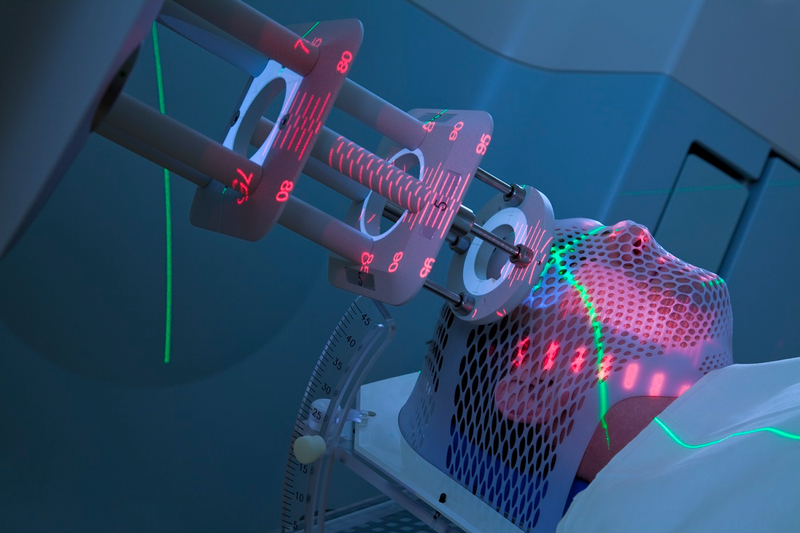 Những phương pháp điều trị u màng não hiệu quả, phổ biến nhất mà bạn nên biết 3